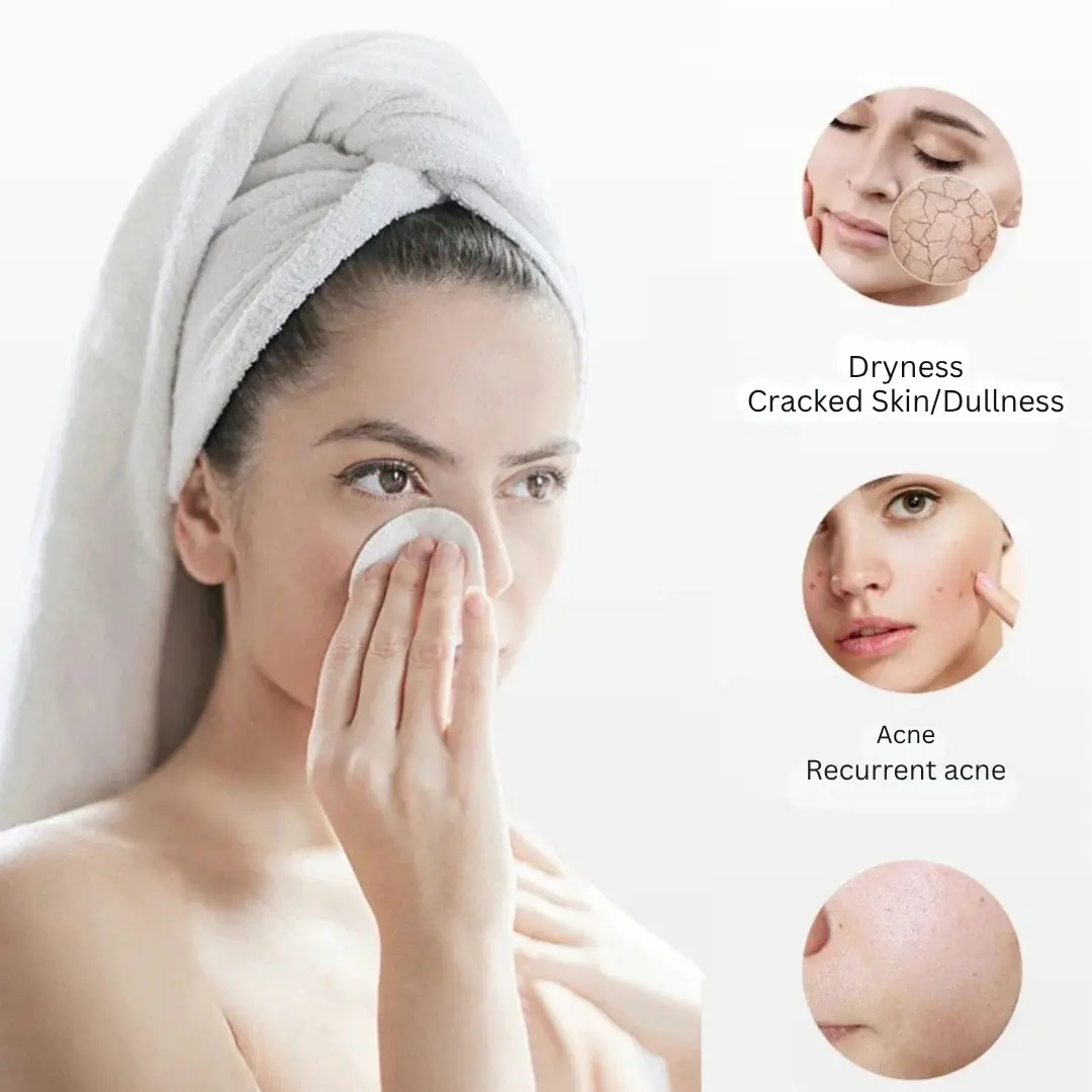Hydra Facial Machine Functions
